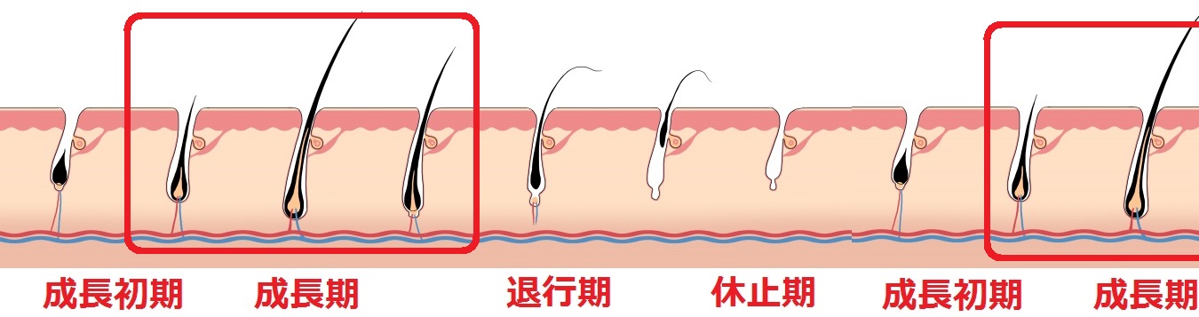 レーザー脱毛もフラッシュ脱毛は成長期