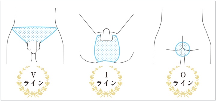 サオとタマはブラジリアンワックス脱毛できない
