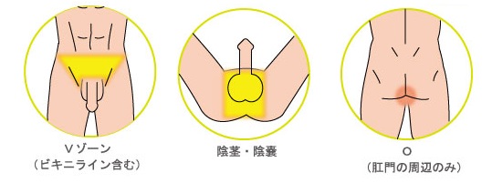 ＶＩＯにタマも含まれる