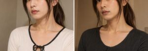 女装前にヒゲを剃った直後と時間がたって青みが出た口まわりの比較