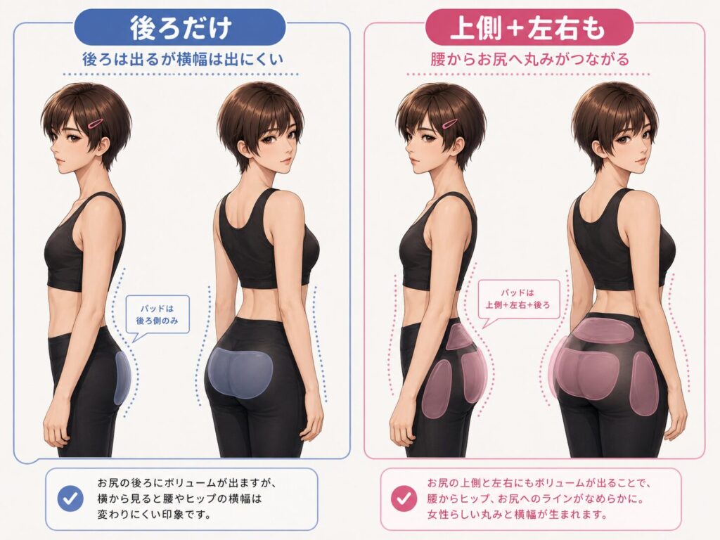 女装ヒップパッドを後ろだけに入れた場合と上側左右にも入れた場合の比較